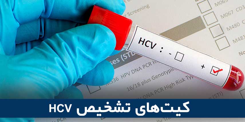 کیت‌های تشخیص HCV