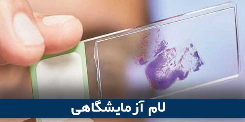 لام آزمایشگاهی