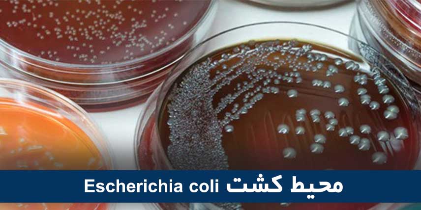 Escherichia coli culture medium