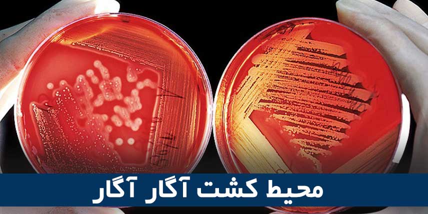 Agar agar culture medium